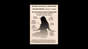 'After Brain Death' and Other Poetry by Joshua C. Frank 3 ‘After Brain Death’ and Other Poetry by Joshua C. Frank