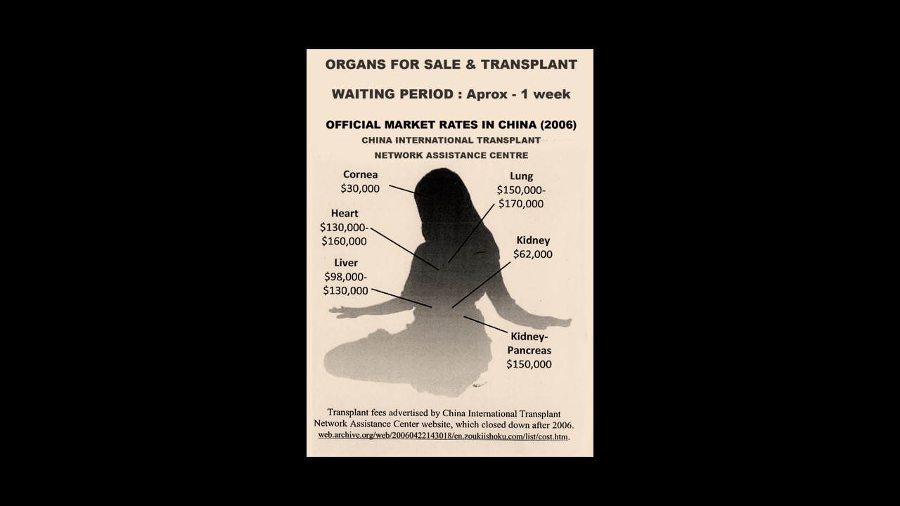 ‘After Brain Death’ and Other Poetry by Joshua C. Frank
