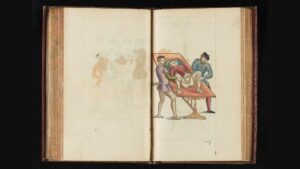 A Poem on Cystolitholapaxy, by Jeff Eardley