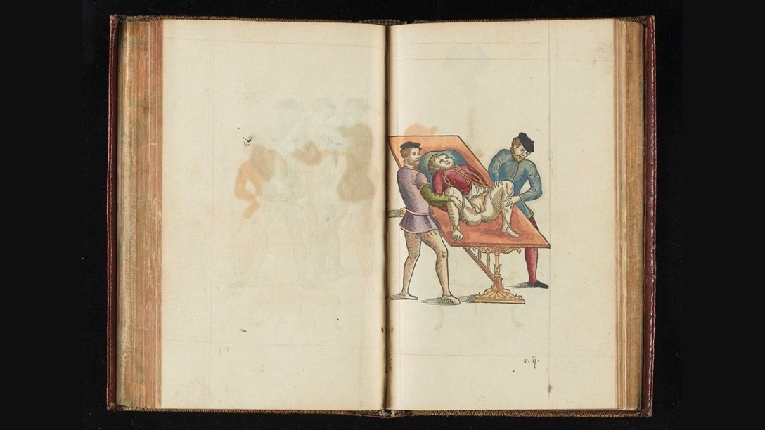 A Poem on Cystolitholapaxy, by Jeff Eardley