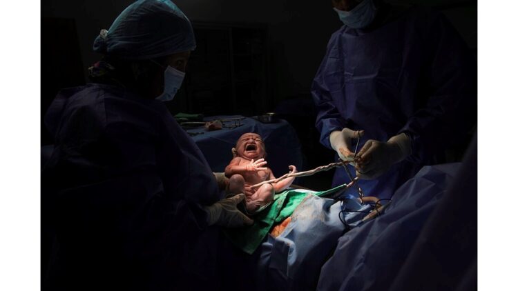 a photo of a new born baby crying (public domain)
