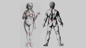 ‘Fibromytrauma’: A Poem by Golan Shahar