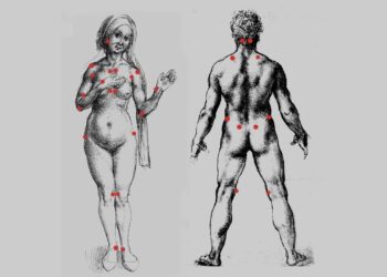 ‘Fibromytrauma’: A Poem by Golan Shahar